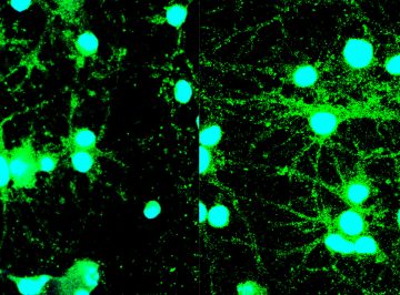 【Published】Hyperexcitability in Cultured Cortical Neuron Networks from the G93A-SOD1 Amyotrophic Lateral Sclerosis Model Mouse and its Molecular Correlates