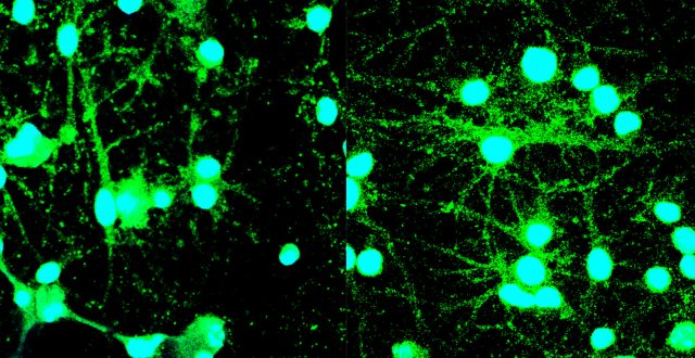 【Published】Hyperexcitability in Cultured Cortical Neuron Networks from the G93A-SOD1 Amyotrophic Lateral Sclerosis Model Mouse and its Molecular Correlates