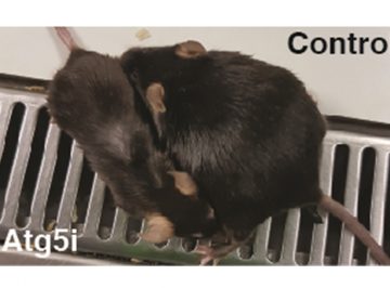 Complex relationship between autophagy-mediated anti-ageing effect and cancer disposition