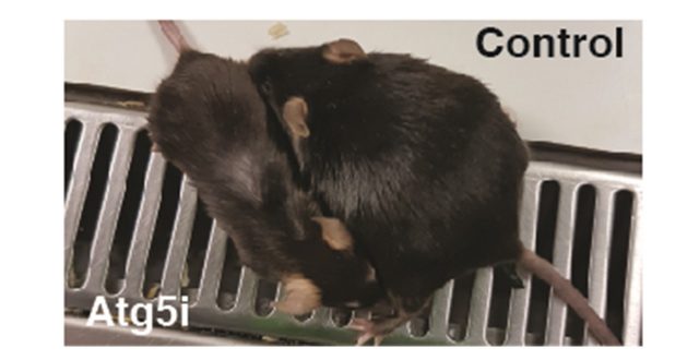 Complex relationship between autophagy-mediated anti-ageing effect and cancer disposition