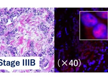 組織の細胞集団に潜む幹細胞のエピゲノム解析手法を開発 ー がん組織の精密プロファイリングに成功
